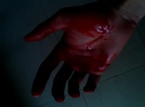 21流鼻血 没找到纸瞳(生长)2010-03-28 21:47:17割腕会喷的白洁悉(0