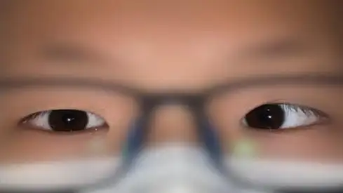 医生:赶紧手术!_内斜视_诸力伟_情况