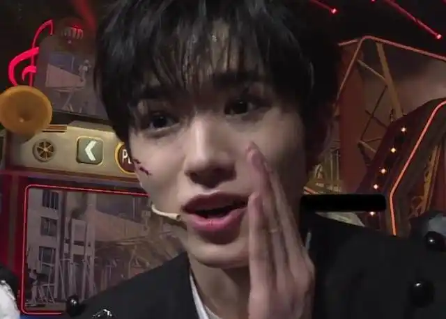 宋亚轩大笑时被怼脸拍,脸上两个坑格外清晰,是否整过一目了然?