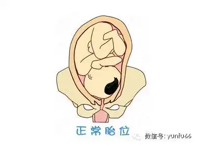 关于胎位不正的那些事儿