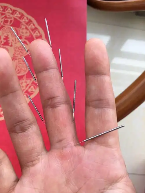 自己给自己扎手针