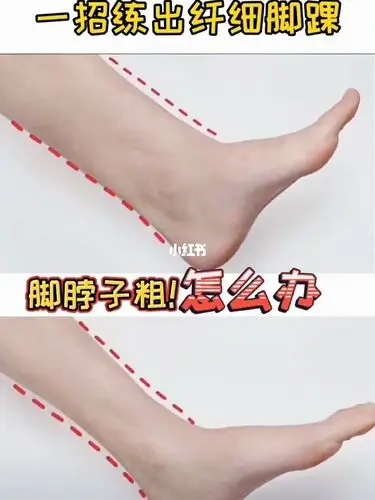 脚踝一肿胖10斤脚脖子粗小腿显短显粗一招轻松拥有纤细脚踝变瘦变美变
