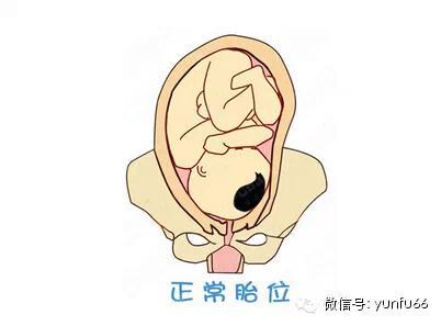 关于胎位不正的那些事儿